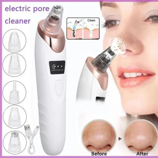 🌟 Face Vacuum Blackhead Remover | Electric Deep Cleansing Tool 🌟 The Etimad Store